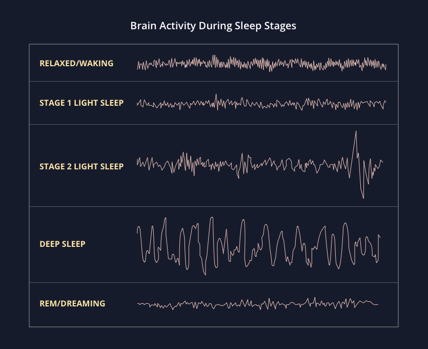 SleepSpace's articulation of the different sleep stages, wake, light, deep, and REM