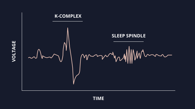 Sleep Brainwaves including a Sleep Spindle and K-Complex