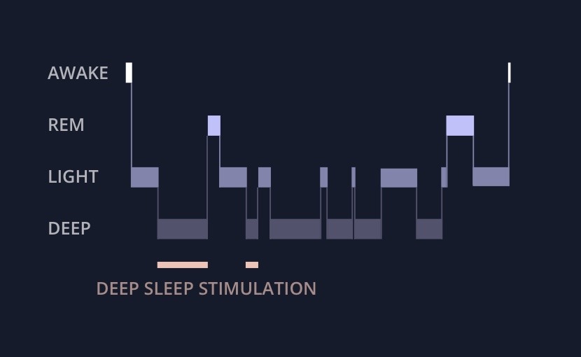 Picture demonstration of how deep sleep stimulation works by playing sounds targeted during deep sleep.