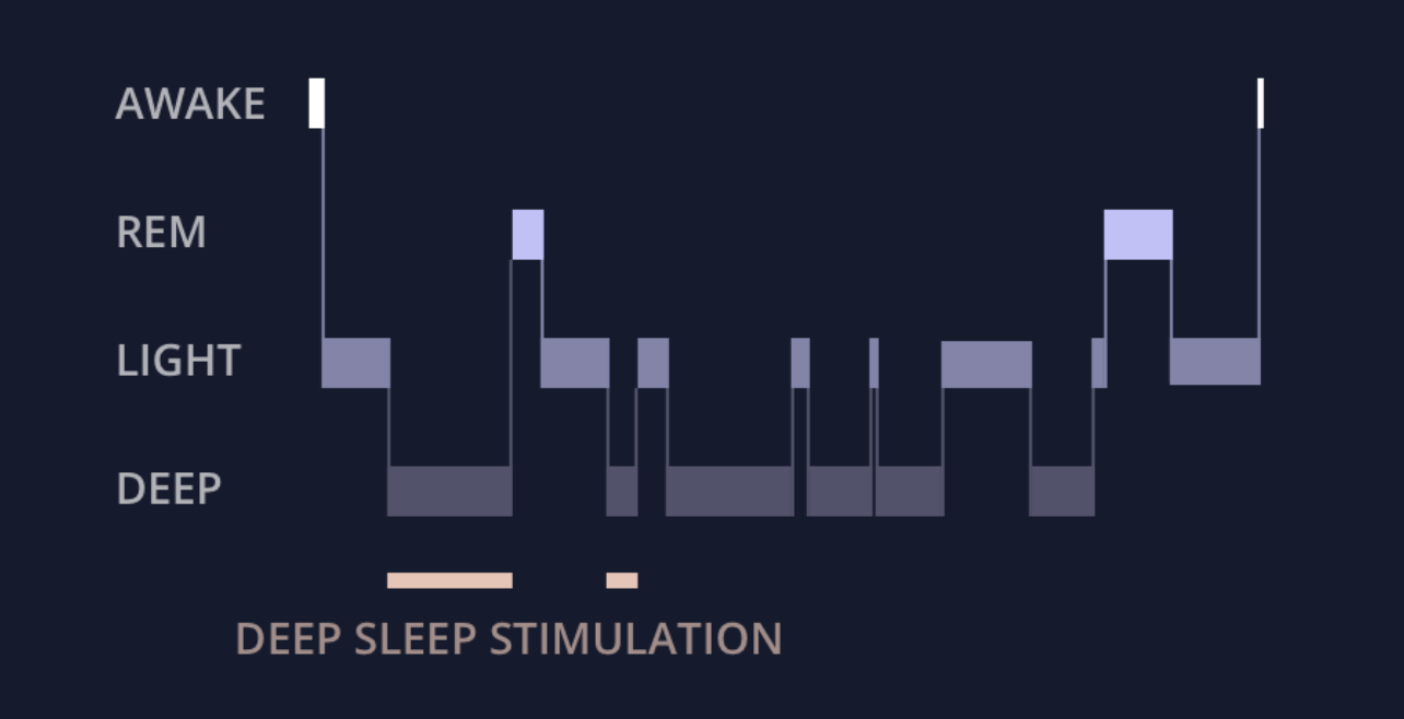 lucid-dream
